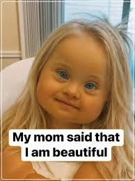 Find 5 differences in the image