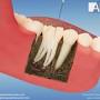 Ilham Dental Clinic Dubai from m.facebook.com