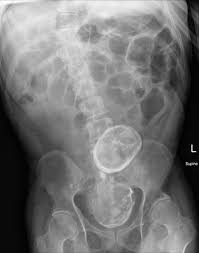 Pin On Medicine