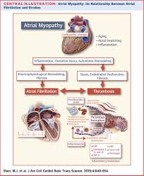 Image result for Myopathy