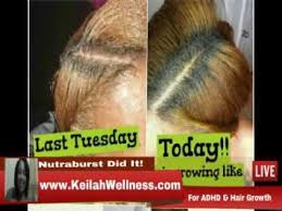 Coconut oil is a good remedy for dry, dull, and damaged hair. Best Liquid Hair Vitamin For Black Women Nutraburst Testimonials Blac Black Hair Vitamins Hair Growth Hair Vitamins