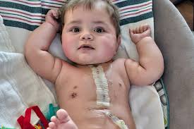 Fundraiser by Jane Fortier : Baby Samico our Little Heart Warrior