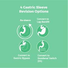 gastric byp and gastric sleeve