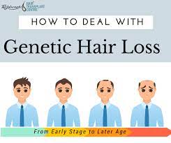 Hair loss can start as soon as puberty ends, depending on your hereditary sensitivity to dht. How To Deal With Genetic Hair Loss Rejuvenate Hair