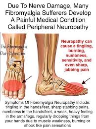 Yes I Have This In My Lower Leg And It S So Painful Fibromyalgia Causes Fibromyalgia Symptoms Peripheral Neuropathy
