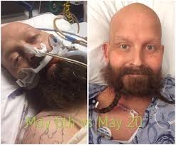 To all of those that prayed for Braydin and Nicole Williams Price, he made  it out of surgery. He had to have multiple plates and screws inserted, but  he is alive. Thank