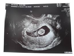 How can you tell how far along you are. How Far Along Am I November 2017 Babies Forums What To Expect Page 2
