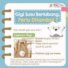 Jenis gigi berlubang yang bisa ditambal. Gigi Berlubang Perlukah Ditambal Kidz Dental Care