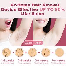 The process involves inserting a needle probe under the skin into the hair follicle. Laser Hair Removal For Women Permanent At Home Lazer Hair Removal Device Painless Laser Hair Remover Machine Whole Body Facial Hair Removal For Women Face Armpits Arms Legs Bikini Chest Pricepulse