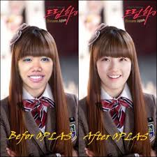 #artis korea cantik tanpa operasi plastik #bae suzy . Suzy Miss A Sebelum Dan Sesudah Operasi Plastik Oplas Woow Banget Yaaa