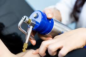 Image result for Cryotherapy