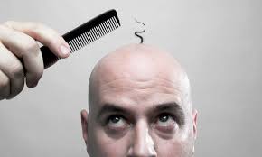 Thank you for asking about your hair shedding after your face lift.yes, hair shedding after any surgery can be normal.the anesthesia and stress of surgery puts the hair follicles into a resting phase.this leads to extensive shedding of hair usually 2 months later.the hair usually fully. How Close Is A Cure For Baldness Men S Hair The Guardian