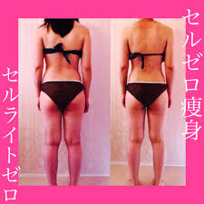 くびれをつくるぞ！】ハイパーナイフを超えるセルゼロで集中部分痩せ | 横浜青葉台シミ毛穴たるみ改善専門のエステ美キュート