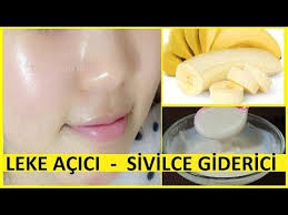 Muz Ile Cilt Beyazlatici Yuz Maskesi Leke Acar Sivilceleri Yok Eden Maske Nemlendirici Guzellik Youtube Maskeler Yuzler Cilt Bakimi