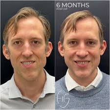 Todd Hanna, MD, DDS, FACS