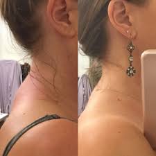 Sirttaki Kamburu Yok Eden Hareket Saglik Paylasimlari Saglik Saglik Ve Fitness Vucut Egzersizleri