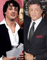 Pin On Celebrities Before After