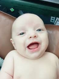 Baby Might Have Horner S Syndrome August 2016 Babycenter Canada