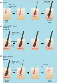 Speaking to the huffington post uk, dr helen webberley, the dedicated gp for oxford online pharmacy, confirmed that woman may experience changes to their pubic hair following the menopause,. Androgens And Hair A Biological Paradox With Clinical Consequences Chapter 7 Testosterone