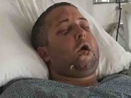 Fundraiser for Brian Ciccone by Zachary Cardoso : A New Smile