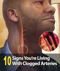 The Silent Signs of Arterial Blockages You Can't Ignore !!!