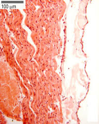 This type is called pleural mesothelioma. Circulatory System The Histology Guide