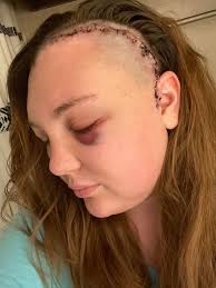 Hi can everyone pray for me as I prepare to go do a brain surgery in couple  weeks. I pray everything will work out and I will be able to get by