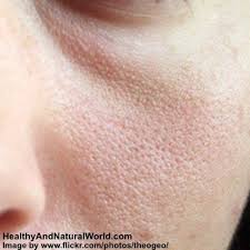 Amazing Natural Treatments To Shrink Your Pores Beauty Hacks Beauty Remedies Beauty Care