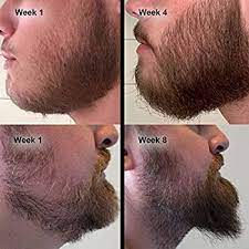 Growing out your facial hair. Beard Growth Kit Hair Growth Hair Serum Beard Growth Oil And Beard Roller Hair Growth For Men Stimulate Beard Growth With Our Beard Serum And Growth Roller