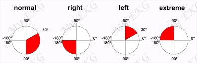 Heart Axis Calculation