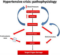 frontiers cardiovascular hypertensive crisis recent