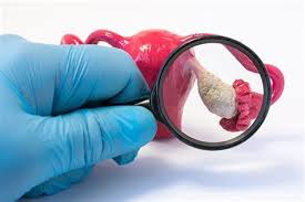 Vitamina c alcalina 4 capsule pe zi; Chisturile Ovariene Ce Sunt De Cate Feluri Simptome Cauze Si Tratament