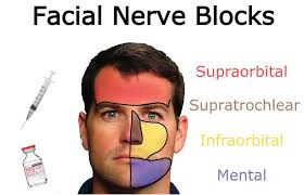 Image result for Ear Nerve Block