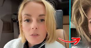 Des parents ont fait opérer leur fille pour enlever une tache de naissance  rare, car “les gens l'auraient dévisager”