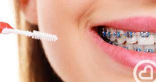 Check spelling or type a new query. Braces Keeping Teeth Clean No Matter Where And When Familiprix