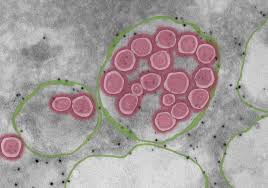 These topics are discussed further in the text, which also includes sources for all the values listed. Sars Cov 2 Exits Cells Via Lysosomes The Scientist Magazine