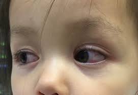 Some people are infected but don't notice any symptoms. Covid 19 In Kids It S Not A Small Problem Jems