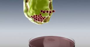 A New International Consortium To Promote Stem Cell Based Therapy For Huntington S Disease Hospital Clinic Barcelona