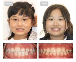 Ortho St-Jean Orthodontistes
