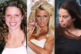 Two children with her former husband. Unbalanced And Scarred Filled With Pockets Of Water Damning Verdict On Katie Price S New Face As We Detail Her Surgery Journey Mirror Online