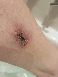 We slathered ourselves in baby oil to bake like rotisserie chickens