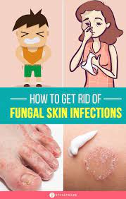 We've got a full line of 100% natural, homeopathic products that can your blissful remedies for getting rid of yeast infections. How To Get Rid Of Fungal Skin Infections 11 Home Remedies Fungal Infection Skin Skin Infection Fungal Infection