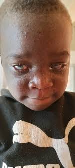 Christopher Shakafuswa