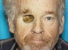 MISSING ADULT*** ***NEEDS MEDICATION*** Edward Naughton, age 72, M/W, 5'9”  tall and 170 pounds, gray hair and one missing eye. Last seen today wearing  black jacket, black sweatpants, and no shoes in