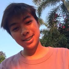 Heart Surgery for Josh Dallin