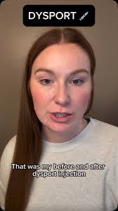DYSPORT 💉 38 units , #stillaesthetics #omahamedspa #omahabotox  #omahadysport #omahanebraska