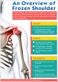 Pin Oleh Paul C Murphy Md Di Great Infographics