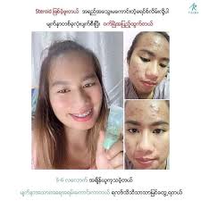 IAura Gel&Suncreen Yangon