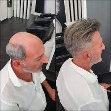 Quanto costano le protesi per capelli? Protesi Capelli Uomo Torino Off 68 Panaelemente Com Tr