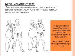 Image result for Hawkins Test